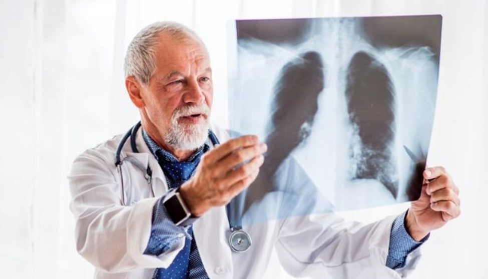 doctor wearing white coat holding up a xray of lungs 
