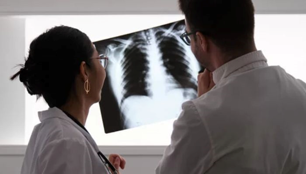 female doctor wearing glasses looking at lung xray with male doctor wearing glasses.